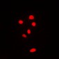 Anti-RPL11 Antibody